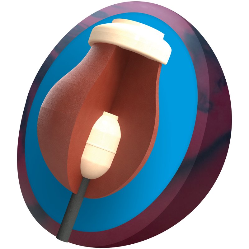 Columbia 300 Cuda PowerCOR Bowling Ball Core