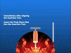 Installing a Vise Ball IT Video